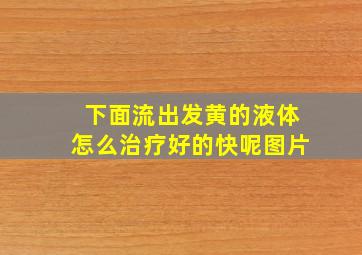 下面流出发黄的液体怎么治疗好的快呢图片