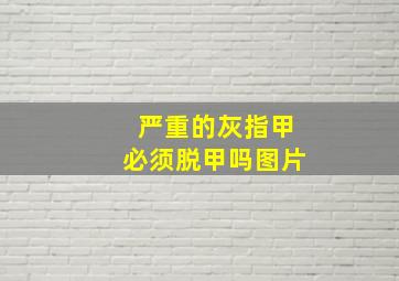 严重的灰指甲必须脱甲吗图片