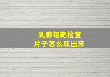 乳腺钼靶检查片子怎么取出来