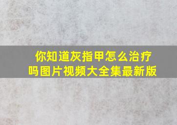 你知道灰指甲怎么治疗吗图片视频大全集最新版