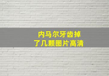 内马尔牙齿掉了几颗图片高清