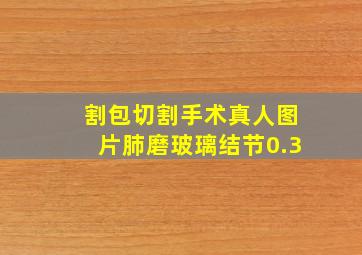 割包切割手术真人图片肺磨玻璃结节0.3