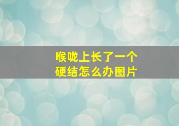 喉咙上长了一个硬结怎么办图片