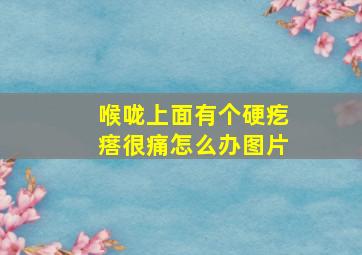 喉咙上面有个硬疙瘩很痛怎么办图片