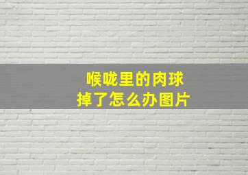 喉咙里的肉球掉了怎么办图片