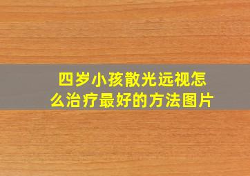 四岁小孩散光远视怎么治疗最好的方法图片