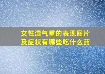 女性湿气重的表现图片及症状有哪些吃什么药