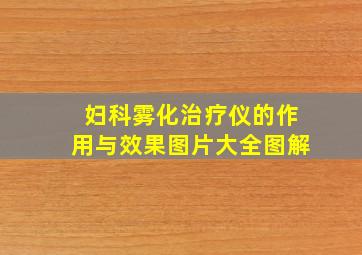 妇科雾化治疗仪的作用与效果图片大全图解