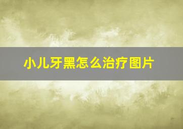 小儿牙黑怎么治疗图片