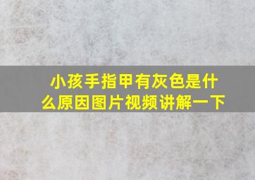 小孩手指甲有灰色是什么原因图片视频讲解一下