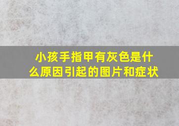 小孩手指甲有灰色是什么原因引起的图片和症状