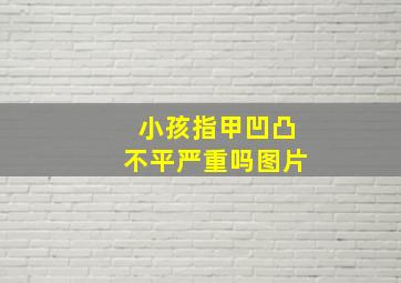 小孩指甲凹凸不平严重吗图片