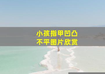 小孩指甲凹凸不平图片欣赏