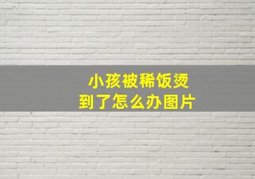 小孩被稀饭烫到了怎么办图片