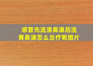 感冒先流清鼻涕后流黄鼻涕怎么治疗呢图片