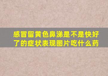 感冒留黄色鼻涕是不是快好了的症状表现图片吃什么药