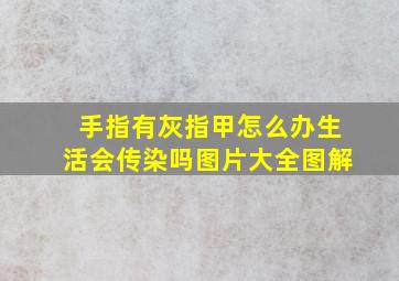 手指有灰指甲怎么办生活会传染吗图片大全图解