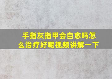 手指灰指甲会自愈吗怎么治疗好呢视频讲解一下