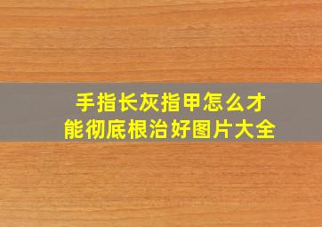 手指长灰指甲怎么才能彻底根治好图片大全