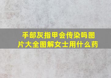 手部灰指甲会传染吗图片大全图解女士用什么药