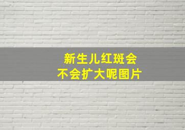 新生儿红斑会不会扩大呢图片