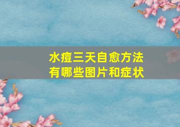 水痘三天自愈方法有哪些图片和症状