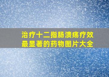 治疗十二指肠溃疡疗效最显著的药物图片大全