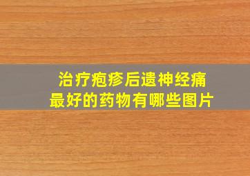 治疗疱疹后遗神经痛最好的药物有哪些图片