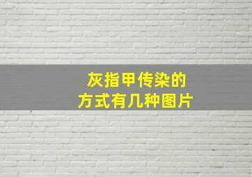 灰指甲传染的方式有几种图片