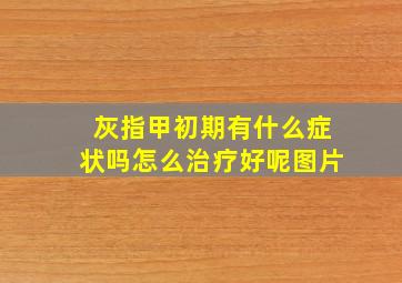 灰指甲初期有什么症状吗怎么治疗好呢图片