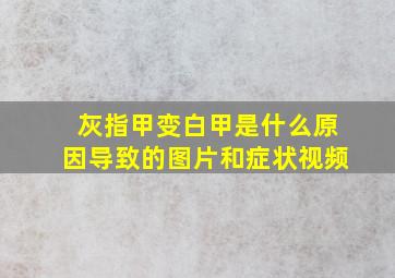 灰指甲变白甲是什么原因导致的图片和症状视频