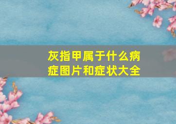 灰指甲属于什么病症图片和症状大全