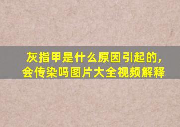 灰指甲是什么原因引起的,会传染吗图片大全视频解释