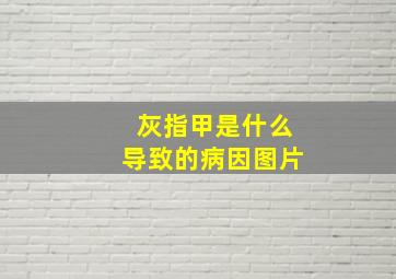 灰指甲是什么导致的病因图片