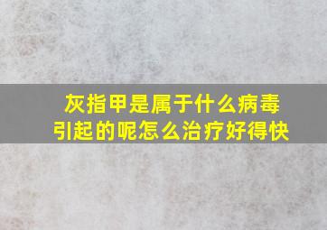 灰指甲是属于什么病毒引起的呢怎么治疗好得快