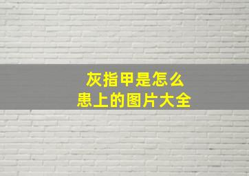 灰指甲是怎么患上的图片大全