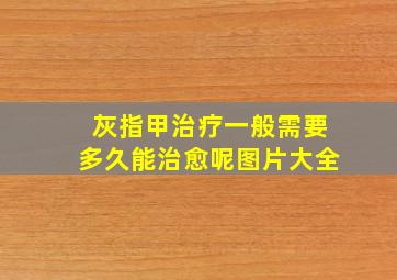 灰指甲治疗一般需要多久能治愈呢图片大全