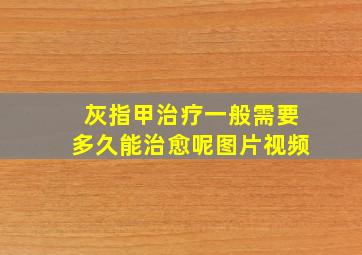 灰指甲治疗一般需要多久能治愈呢图片视频