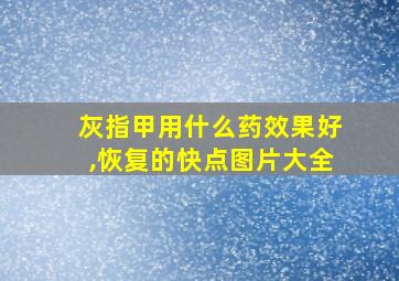 灰指甲用什么药效果好,恢复的快点图片大全