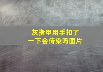 灰指甲用手扣了一下会传染吗图片