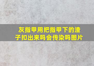 灰指甲用把指甲下的渣子扣出来吗会传染吗图片