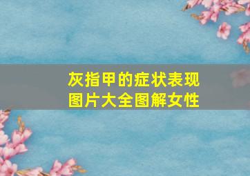 灰指甲的症状表现图片大全图解女性