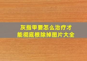 灰指甲要怎么治疗才能彻底根除掉图片大全