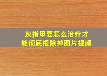 灰指甲要怎么治疗才能彻底根除掉图片视频