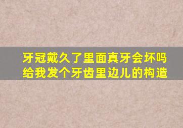 牙冠戴久了里面真牙会坏吗给我发个牙齿里边儿的构造