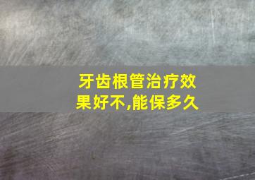 牙齿根管治疗效果好不,能保多久