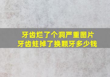 牙齿烂了个洞严重图片牙齿蛀掉了换颗牙多少钱