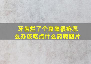 牙齿烂了个窟窿很疼怎么办该吃点什么药呢图片