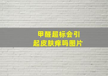 甲醛超标会引起皮肤痒吗图片