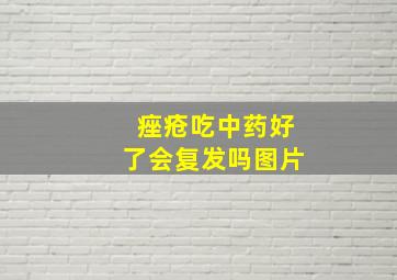 痤疮吃中药好了会复发吗图片